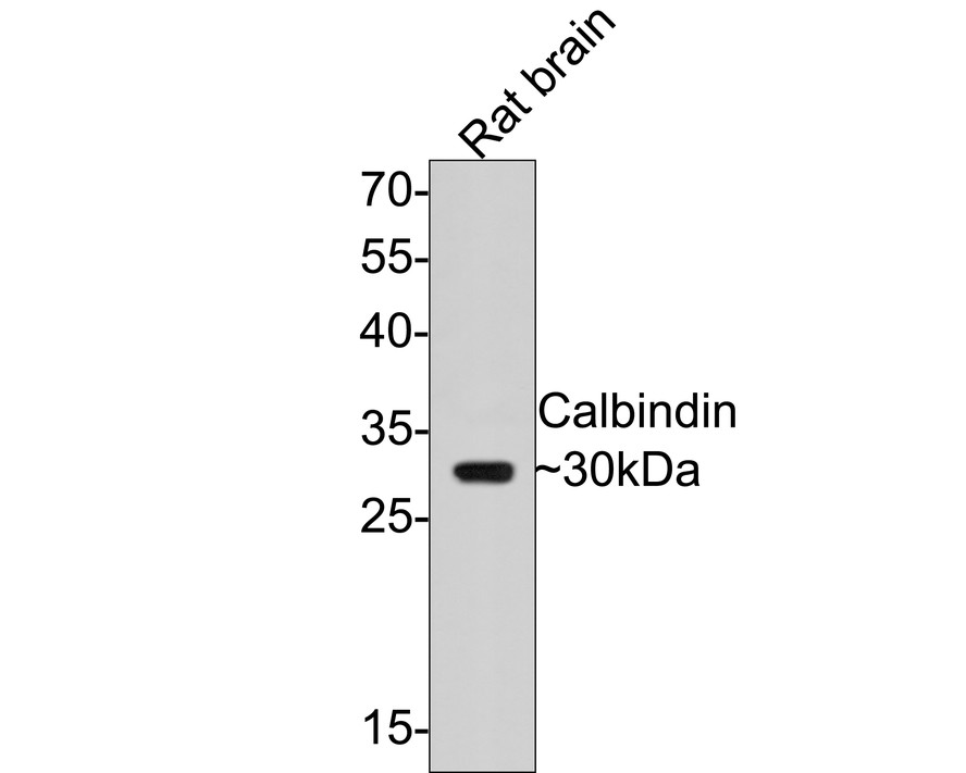 Western blot analysis of Calbindin on rat brain tissue lysates with Rabbit anti-Calbindin antibody (ET1702-54) at 1/5,000 dilution.<br />
<br />
Lysates/proteins at 20 µg/Lane.<br />
<br />
Predicted band size: 30 kDa<br />
Observed band size: 30 kDa<br />
<br />
Exposure time: 1 minute;<br />
<br />
12% SDS-PAGE gel.<br />
<br />
Proteins were transferred to a PVDF membrane and blocked with 5% NFDM/TBST for 1 hour at room temperature. The primary antibody (ET1702-54) at 1/5,000 dilution was used in 5% NFDM/TBST at room temperature for 2 hours. Goat Anti-Rabbit IgG - HRP Secondary Antibody (HA1001) at 1:300,000 dilution was used for 1 hour at room temperature.