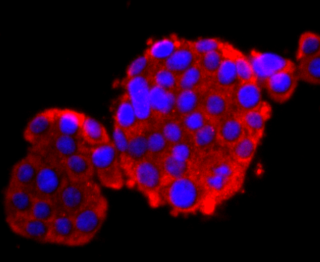 ICC staining Calbindin in 293T cells (red). The nuclear counter stain is DAPI (blue). Cells were fixed in paraformaldehyde, permeabilised with 0.25% Triton X100/PBS.