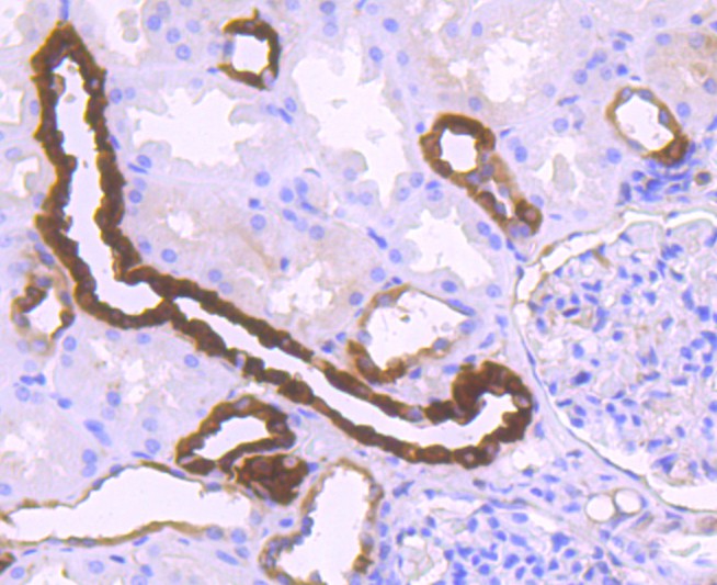 Immunohistochemical analysis of paraffin-embedded mouse brain tissue using anti-Calbindin antibody. Counter stained with hematoxylin.