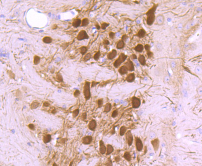 Immunohistochemical analysis of paraffin-embedded mouse kidney tissue using anti-Calbindin antibody. Counter stained with hematoxylin.