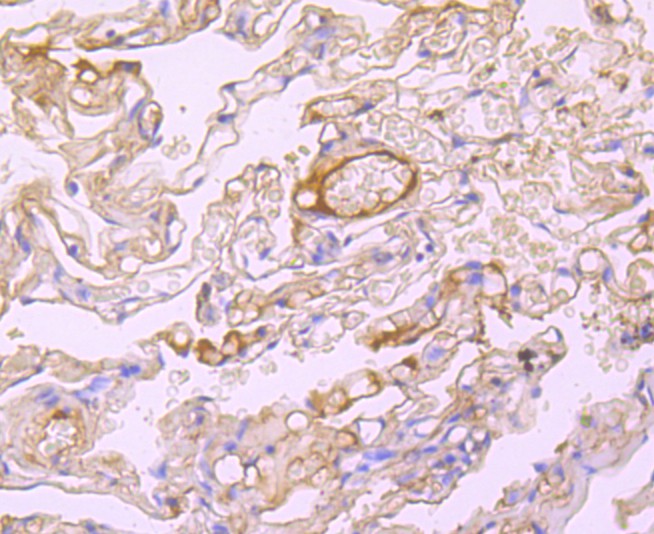 Immunohistochemical analysis of paraffin-embedded human liver tissue using anti-Albumin antibody. The section was pre-treated using heat mediated antigen retrieval with Tris-EDTA buffer (pH 8.0-8.4) for 20 minutes.The tissues were blocked in 5% BSA for 30 minutes at room temperature, washed with ddH2O and PBS, and then probed with the primary antibody (ET1702-55, 1/50) for 30 minutes at room temperature. The detection was performed using an HRP conjugated compact polymer system. DAB was used as the chromogen. Tissues were counterstained with hematoxylin and mounted with DPX.