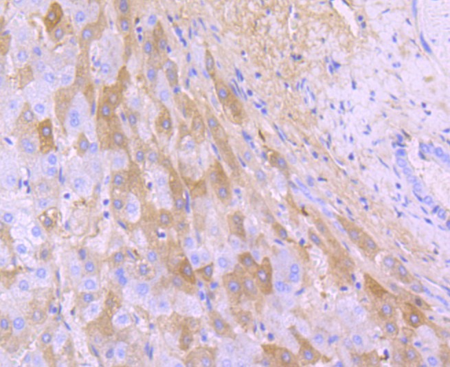 Immunohistochemical analysis of paraffin-embedded human spleen tissue using anti-Albumin antibody. The section was pre-treated using heat mediated antigen retrieval with Tris-EDTA buffer (pH 8.0-8.4) for 20 minutes.The tissues were blocked in 5% BSA for 30 minutes at room temperature, washed with ddH2O and PBS, and then probed with the primary antibody (ET1702-55, 1/50) for 30 minutes at room temperature. The detection was performed using an HRP conjugated compact polymer system. DAB was used as the chromogen. Tissues were counterstained with hematoxylin and mounted with DPX.