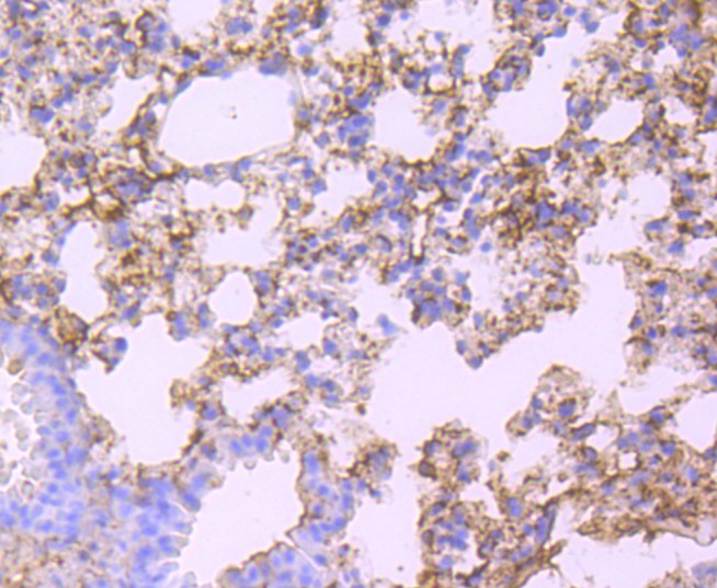 Immunohistochemical analysis of paraffin-embedded mouse liver tissue using anti-Albumin antibody. The section was pre-treated using heat mediated antigen retrieval with Tris-EDTA buffer (pH 8.0-8.4) for 20 minutes.The tissues were blocked in 5% BSA for 30 minutes at room temperature, washed with ddH2O and PBS, and then probed with the primary antibody (ET1702-55, 1/50) for 30 minutes at room temperature. The detection was performed using an HRP conjugated compact polymer system. DAB was used as the chromogen. Tissues were counterstained with hematoxylin and mounted with DPX.