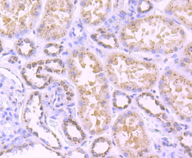 Immunohistochemical analysis of paraffin-embedded human kidney tissue using anti-TGN46 antibody. The section was pre-treated using heat mediated antigen retrieval with Tris-EDTA buffer (pH 9.0) for 20 minutes.The tissues were blocked in 5% BSA for 30 minutes at room temperature, washed with ddH2O and PBS, and then probed with the primary antibody (ET1702-56, 1/50) for 30 minutes at room temperature. The detection was performed using an HRP conjugated compact polymer system. DAB was used as the chromogen. Tissues were counterstained with hematoxylin and mounted with DPX.