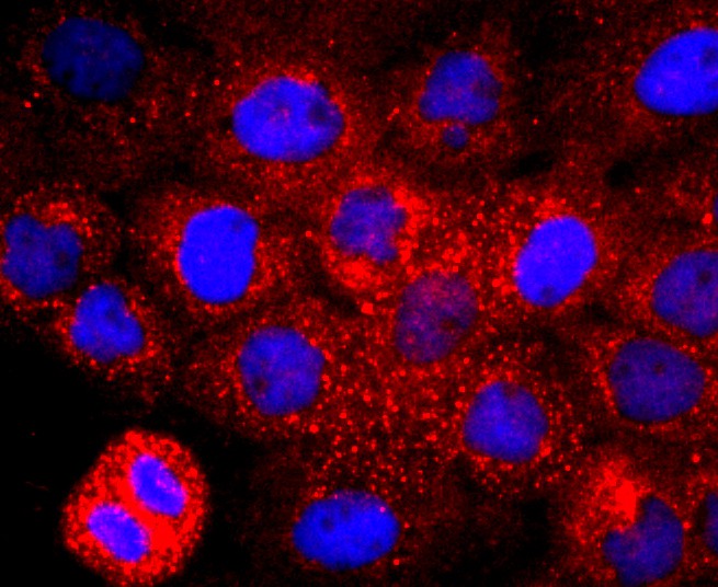 ICC staining of CD147 in A431 cells (red). Formalin fixed cells were permeabilized with 0.1% Triton X-100 in TBS for 10 minutes at room temperature and blocked with 10% negative goat serum for 15 minutes at room temperature. Cells were probed with the primary antibody (ET1702-58, 1/50) for 1 hour at room temperature, washed with PBS. Alexa Fluor®594 conjugate-Goat anti-Rabbit IgG was used as the secondary antibody at 1/1,000 dilution. The nuclear counter stain is DAPI (blue).