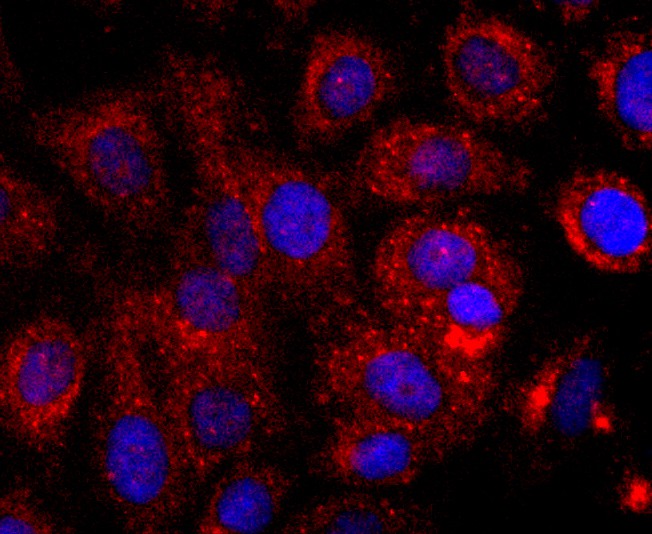 ICC staining of CD147 in SKOV-3 cells (red). Formalin fixed cells were permeabilized with 0.1% Triton X-100 in TBS for 10 minutes at room temperature and blocked with 10% negative goat serum for 15 minutes at room temperature. Cells were probed with the primary antibody (ET1702-58, 1/50) for 1 hour at room temperature, washed with PBS. Alexa Fluor®594 conjugate-Goat anti-Rabbit IgG was used as the secondary antibody at 1/1,000 dilution. The nuclear counter stain is DAPI (blue).