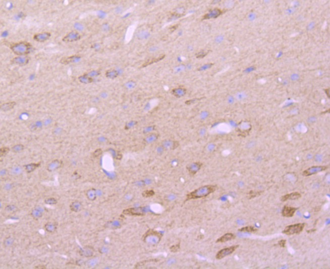 Immunohistochemical analysis of paraffin-embedded mouse brain tissue using anti-CD147 antibody. The section was pre-treated using heat mediated antigen retrieval with Tris-EDTA buffer (pH 9.0) for 20 minutes.The tissues were blocked in 5% BSA for 30 minutes at room temperature, washed with ddH2O and PBS, and then probed with the primary antibody (ET1702-58, 1/50) for 30 minutes at room temperature. The detection was performed using an HRP conjugated compact polymer system. DAB was used as the chromogen. Tissues were counterstained with hematoxylin and mounted with DPX.