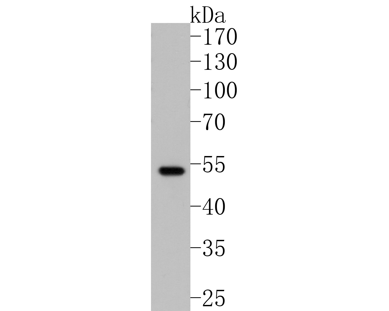 Western blot analysis of Parkin on 293T cell lysates. Proteins were transferred to a PVDF membrane and blocked with 5% BSA in PBS for 1 hour at room temperature. The primary antibody (ET1702-60, 1/500) was used in 5% BSA at room temperature for 2 hours. Goat Anti-Rabbit IgG - HRP Secondary Antibody (HA1001) at 1:5,000 dilution was used for 1 hour at room temperature.