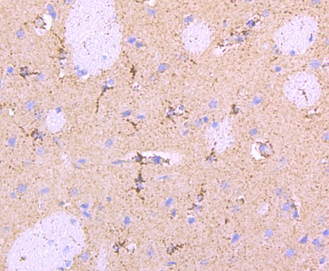 Immunohistochemical analysis of paraffin-embedded rat brain tissue using anti-Parkin antibody. The section was pre-treated using heat mediated antigen retrieval with Tris-EDTA buffer (pH 8.0-8.4) for 20 minutes.The tissues were blocked in 5% BSA for 30 minutes at room temperature, washed with ddH2O and PBS, and then probed with the primary antibody (ET1702-60, 1/50) for 30 minutes at room temperature. The detection was performed using an HRP conjugated compact polymer system. DAB was used as the chromogen. Tissues were counterstained with hematoxylin and mounted with DPX.