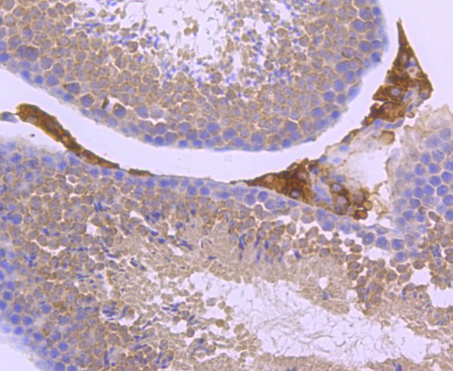 Immunohistochemical analysis of paraffin-embedded mouse testis tissue using anti-Parkin antibody. The section was pre-treated using heat mediated antigen retrieval with Tris-EDTA buffer (pH 8.0-8.4) for 20 minutes.The tissues were blocked in 5% BSA for 30 minutes at room temperature, washed with ddH2O and PBS, and then probed with the primary antibody (ET1702-60, 1/50) for 30 minutes at room temperature. The detection was performed using an HRP conjugated compact polymer system. DAB was used as the chromogen. Tissues were counterstained with hematoxylin and mounted with DPX.