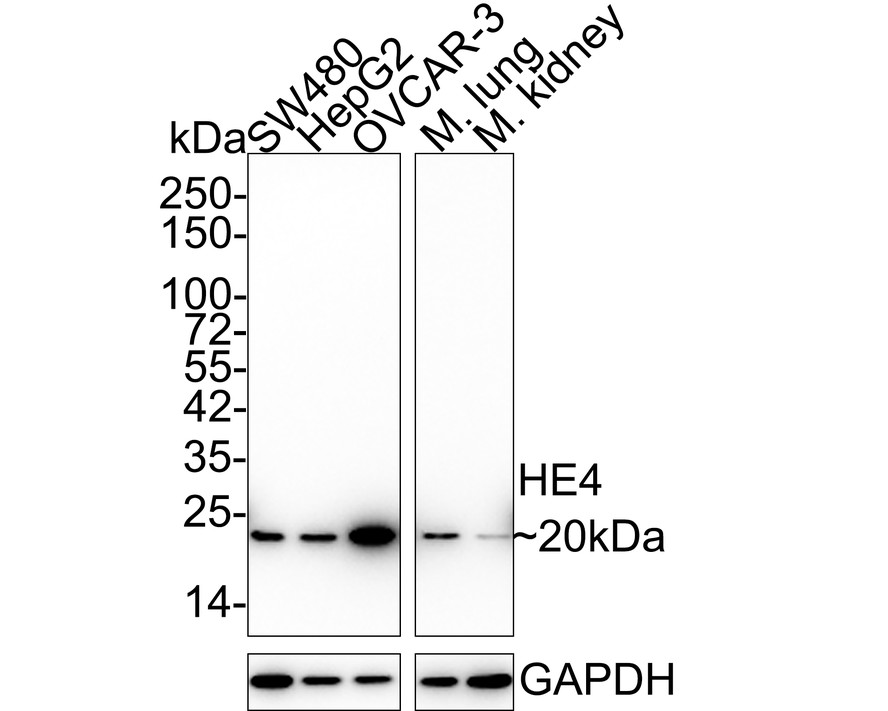 Western blot analysis of HE4 on different lysates with Rabbit anti-HE4 antibody (ET1702-61) at 1/2,000 dilution.<br />
<br />
Lane 1: SW480 cell lysate (15 µg/Lane)<br />
Lane 2: HepG2 cell lysate (15 µg/Lane)<br />
Lane 3: OVCAR-3 cell lysate (15 µg/Lane)<br />
Lane 4: Mouse lung tissue lysate (20 µg/Lane)<br />
Lane 5: Mouse kidney tissue lysate (20 µg/Lane)<br />
<br />
Predicted band size: 13 kDa<br />
Observed band size: 20 kDa<br />
<br />
Exposure time: 1 minute;<br />
<br />
4-20% SDS-PAGE gel.<br />
<br />
Proteins were transferred to a PVDF membrane and blocked with 5% NFDM/TBST for 1 hour at room temperature. The primary antibody (ET1702-61) at 1/2,000 dilution was used in 5% NFDM/TBST at 4℃ overnight. Goat Anti-Rabbit IgG - HRP Secondary Antibody (HA1001) at 1/50,000 dilution was used for 1 hour at room temperature.