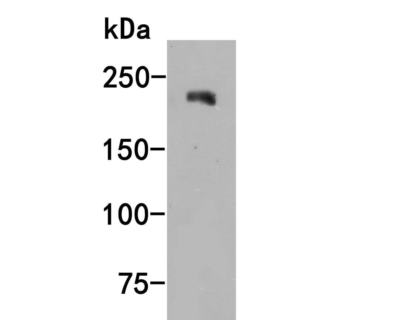 Western blot analysis of Jagged1 on A431 cell lysate. Proteins were transferred to a PVDF membrane and blocked with 5% BSA in PBS for 1 hour at room temperature. The primary antibody (ET1702-63, 1/1,000) was used in 5% BSA at room temperature for 2 hours. Goat Anti-Rabbit IgG - HRP Secondary Antibody (HA1001) at 1:200,000 dilution was used for 1 hour at room temperature.