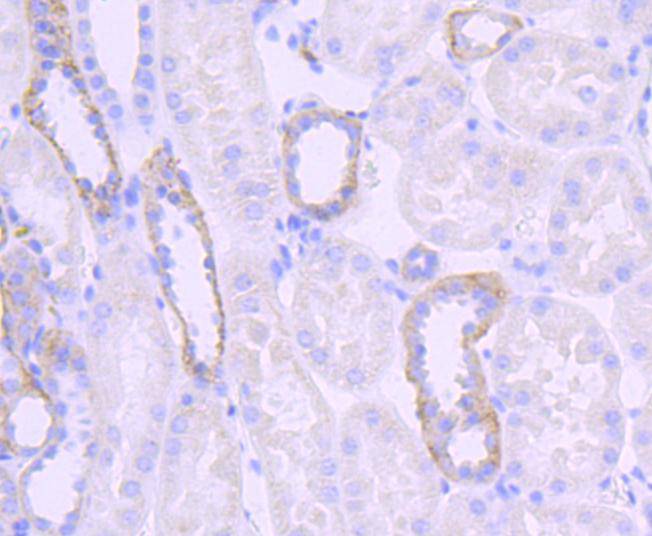 Immunohistochemical analysis of paraffin-embedded human kidney tissue using anti-Jagged1 antibody. Counter stained with hematoxylin.
