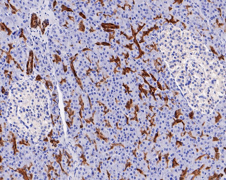 Immunohistochemical analysis of paraffin-embedded human pancreas tissue with Rabbit anti-Midkine antibody (ET1702-64) at 1/1,000 dilution.<br />
<br />
The section was pre-treated using heat mediated antigen retrieval with Tris-EDTA buffer (pH 9.0) for 20 minutes. The tissues were blocked in 1% BSA for 20 minutes at room temperature, washed with ddH2O and PBS, and then probed with the primary antibody (ET1702-64) at 1/1,000 dilution for 1 hour at room temperature. The detection was performed using an HRP conjugated compact polymer system. DAB was used as the chromogen. Tissues were counterstained with hematoxylin and mounted with DPX.