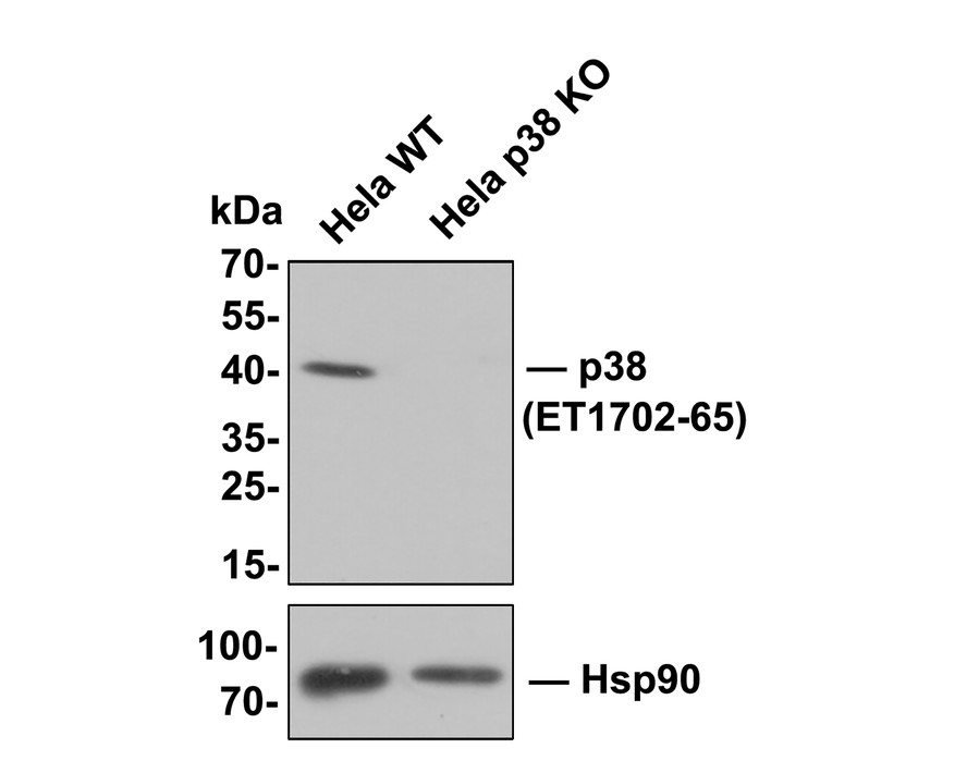 All lanes: Western blot analysis of p38 with anti-p38  antibody[JF55-07]  (ET1702-65) at 1:500 dilution.<br />
Lane 1: Wild-type Hela whole cell lysate (10 µg).<br />
Lane 2: p38 knockout Hela whole cell lysate (10 µg).<br />
<br />
ET1702-65 was shown to specifically react with p38 in wild-type Hela cells. No band was observed when p38 knockout sample was tested. Wild-type and p38 knockout samples were subjected to SDS-PAGE. Proteins were transferred to a PVDF membrane and blocked with 5% NFDM in TBST for 1 hour at room temperature. The primary antibody (ET1702-65, 1/500) was used in 5% BSA at room temperature for 2 hours. Goat Anti-Rabbit IgG-HRP Secondary Antibody (HA1001) at 1:100,000 dilution was used for 1 hour at room temperature.