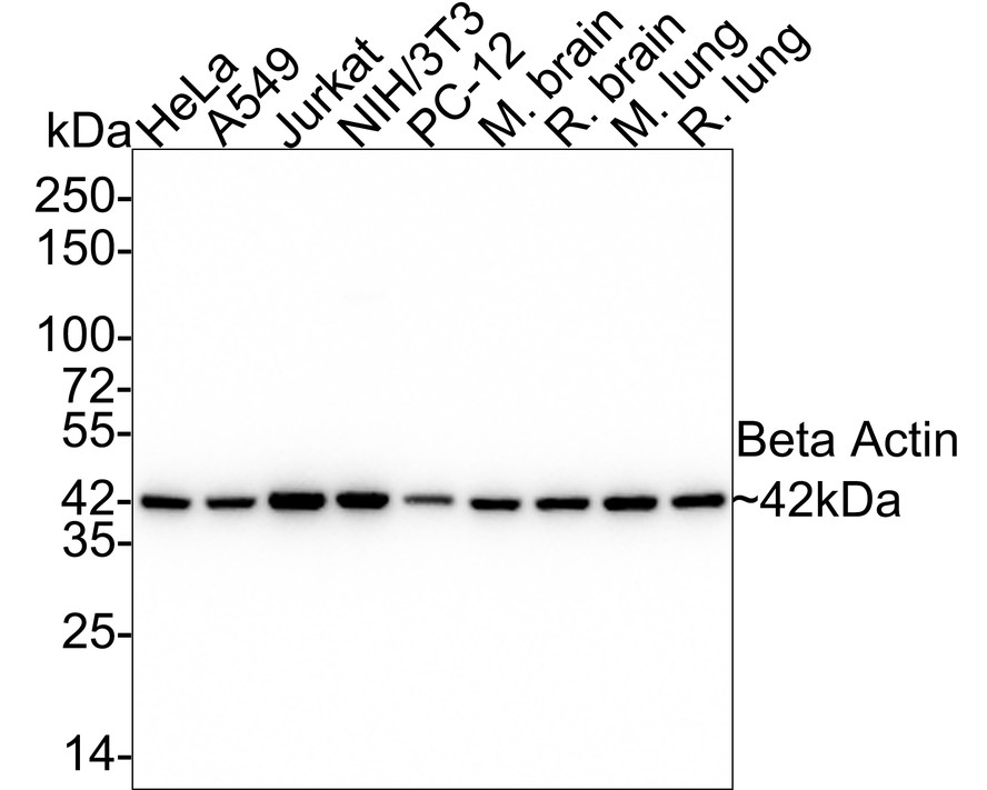 Western blot analysis of beta Actin on different lysates with Rabbit anti-beta Actin antibody (ET1702-67) at 1/10,000 dilution.<br />
<br />
Lane 1: HeLa cell lysate<br />
Lane 2: A549 cell lysate<br />
Lane 3: Jurkat cell lysate<br />
Lane 4: NIH/3T3 cell lysate<br />
Lane 5: PC-12 cell lysate<br />
Lane 6: Mouse brain tissue lysate<br />
Lane 7: Rat brain tissue lysate<br />
Lane 8: Mouse lung tissue lysate<br />
Lane 9: Rat lung tissue lysate<br />
<br />
Lysates/proteins at 20 µg/Lane.<br />
<br />
Predicted band size: 42 kDa<br />
Observed band size: 42 kDa<br />
<br />
Exposure time: 30 seconds;<br />
<br />
4-20% SDS-PAGE gel.<br />
<br />
Proteins were transferred to a PVDF membrane and blocked with 5% NFDM/TBST for 1 hour at room temperature. The primary antibody (ET1702-67) at 1/10,000 dilution was used in 5% NFDM/TBST at room temperature for 2 hours.
