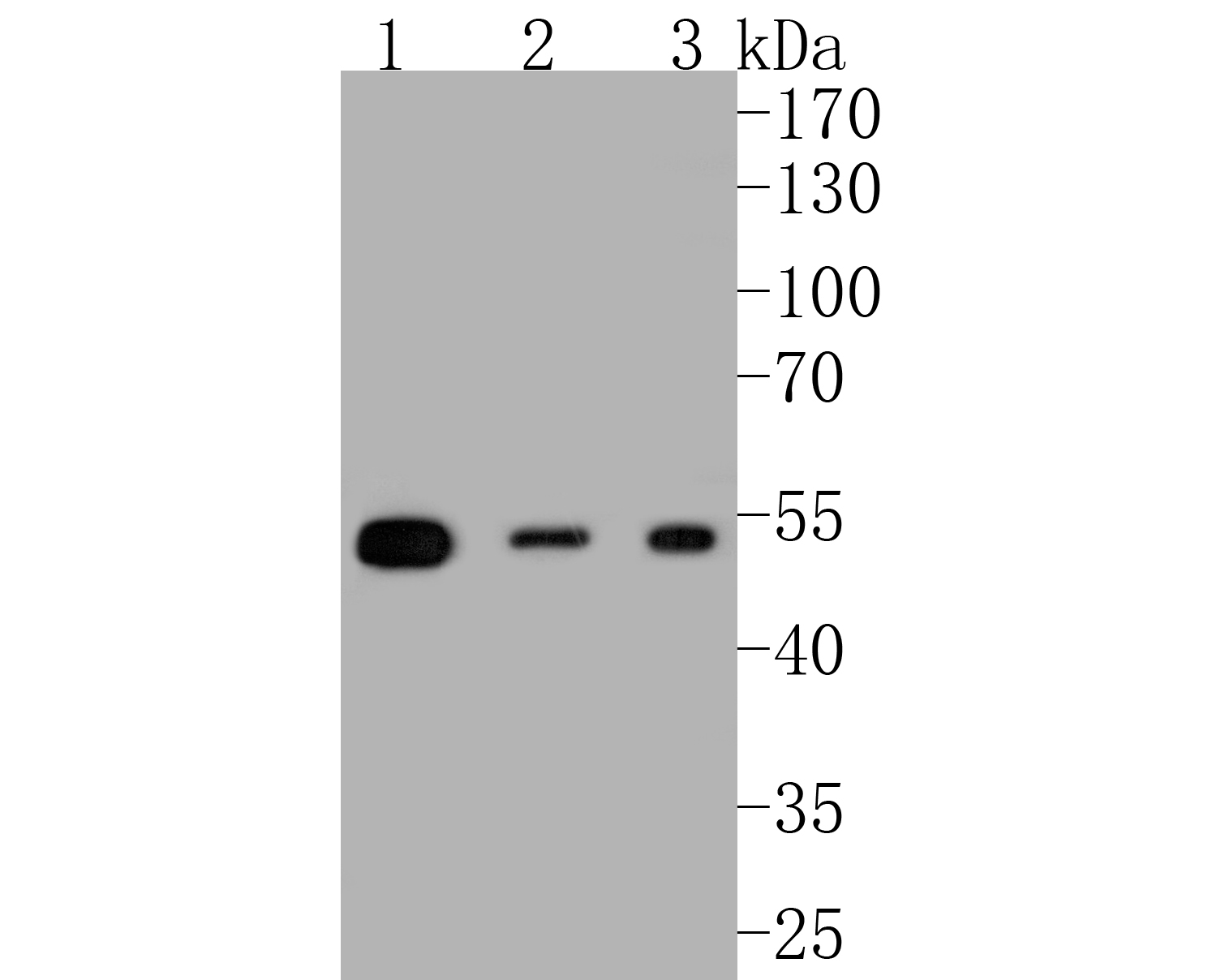 Western blot analysis of beta Tubulin on different lysates. Proteins were transferred to a PVDF membrane and blocked with 5% BSA in PBS for 1 hour at room temperature. The primary antibody (ET1702-68, 1/500) was used in 5% BSA at room temperature for 2 hours. <br />
Positive control: <br />
Lane 1: Hela cell lysate<br />
Lane 2: PC-12 cell lysate<br />
Lane 3: NIH/3T3 cell lysate