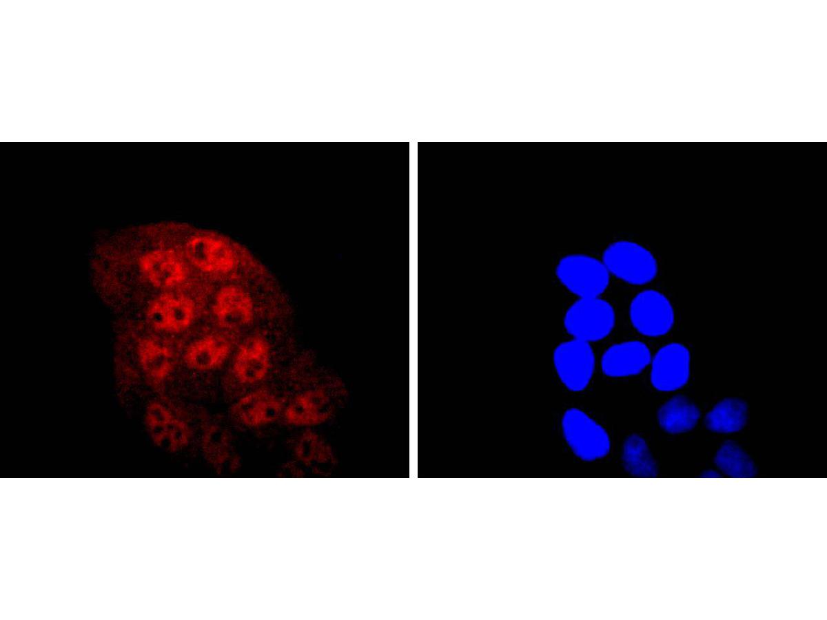 ICC staining of KLF4 in Hela cells (red). Formalin fixed cells were permeabilized with 0.1% Triton X-100 in TBS for 10 minutes at room temperature and blocked with 1% Blocker BSA for 15 minutes at room temperature. Cells were probed with the primary antibody (ET1702-71, 1/50) for 1 hour at room temperature, washed with PBS. Alexa Fluor®594 Goat anti-Rabbit IgG was used as the secondary antibody at 1/1,000 dilution. The nuclear counter stain is DAPI (blue).