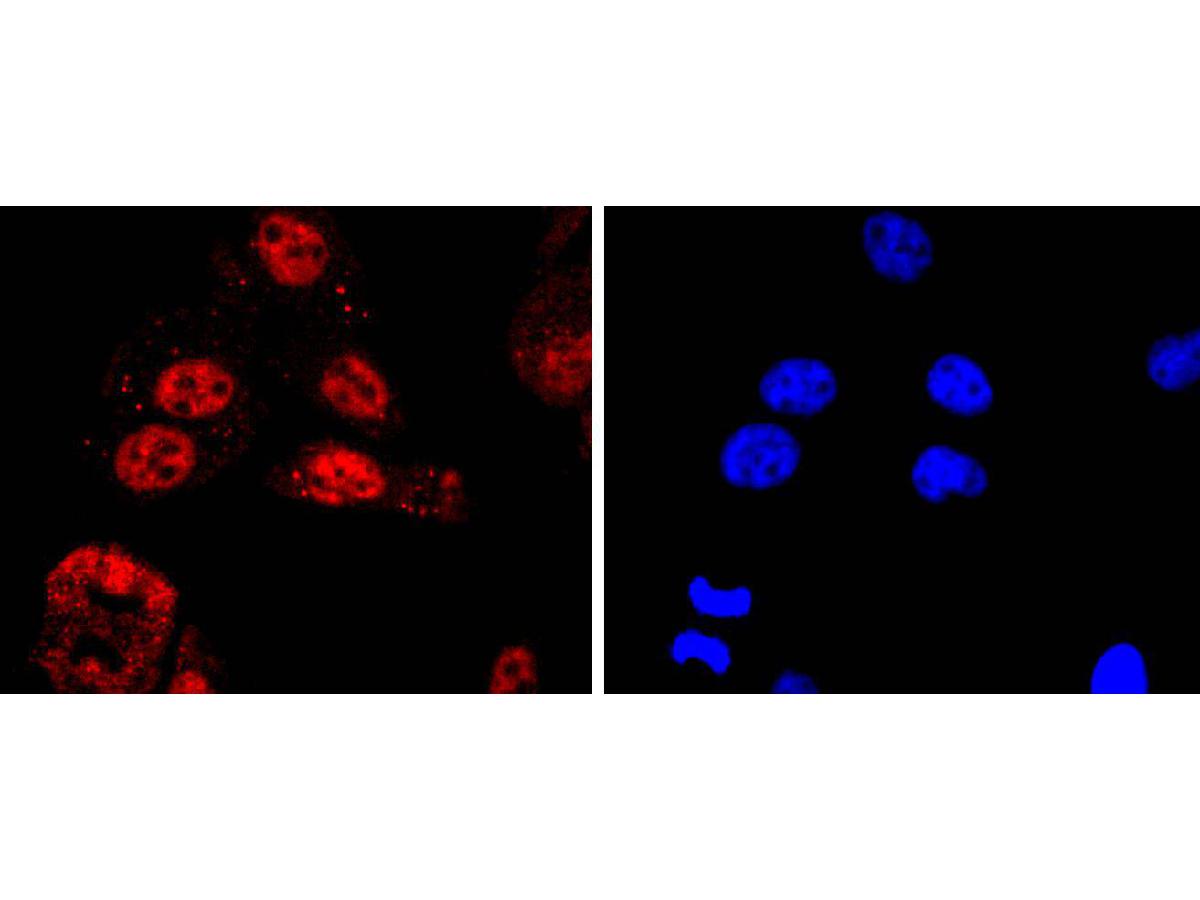 ICC staining of KLF4 in PC-3M cells (red). Formalin fixed cells were permeabilized with 0.1% Triton X-100 in TBS for 10 minutes at room temperature and blocked with 1% Blocker BSA for 15 minutes at room temperature. Cells were probed with the primary antibody (ET1702-71, 1/50) for 1 hour at room temperature, washed with PBS. Alexa Fluor®594 Goat anti-Rabbit IgG was used as the secondary antibody at 1/1,000 dilution. The nuclear counter stain is DAPI (blue).