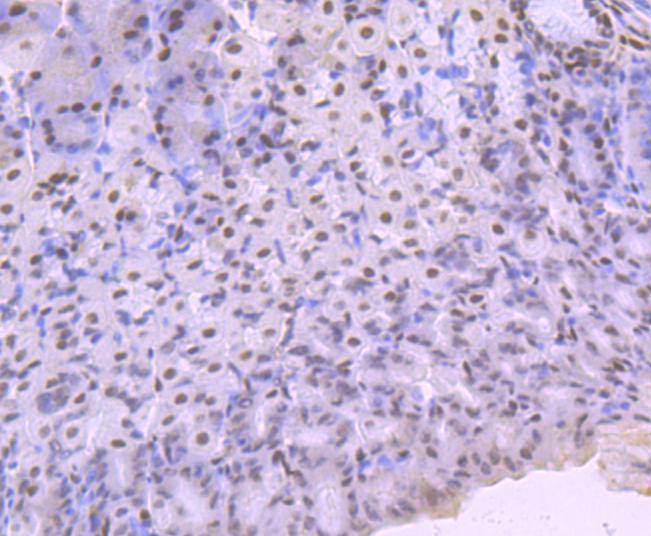 Immunohistochemical analysis of paraffin-embedded mouse stomach tissue using anti-KLF4 antibody. The section was pre-treated using heat mediated antigen retrieval with Tris-EDTA buffer (pH 8.0-8.4) for 20 minutes.The tissues were blocked in 5% BSA for 30 minutes at room temperature, washed with ddH2O and PBS, and then probed with the primary antibody (ET1702-71, 1/50) for 30 minutes at room temperature. The detection was performed using an HRP conjugated compact polymer system. DAB was used as the chromogen. Tissues were counterstained with hematoxylin and mounted with DPX.