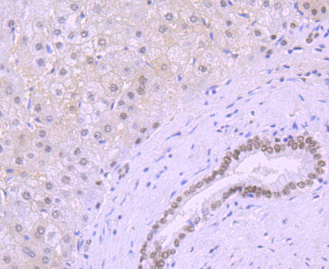 Immunohistochemical analysis of paraffin-embedded human liver tissue using anti-KLF4 antibody. The section was pre-treated using heat mediated antigen retrieval with Tris-EDTA buffer (pH 8.0-8.4) for 20 minutes.The tissues were blocked in 5% BSA for 30 minutes at room temperature, washed with ddH2O and PBS, and then probed with the primary antibody (ET1702-71, 1/50) for 30 minutes at room temperature. The detection was performed using an HRP conjugated compact polymer system. DAB was used as the chromogen. Tissues were counterstained with hematoxylin and mounted with DPX.