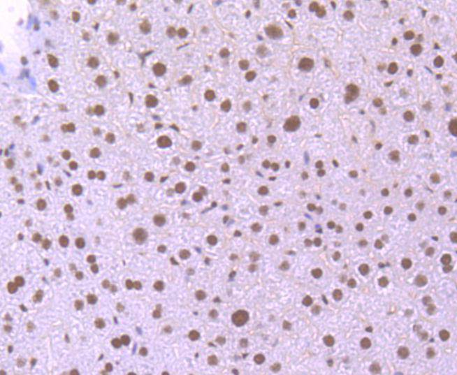 Immunohistochemical analysis of paraffin-embedded mouse liver tissue using anti-KLF4 antibody. The section was pre-treated using heat mediated antigen retrieval with Tris-EDTA buffer (pH 8.0-8.4) for 20 minutes.The tissues were blocked in 5% BSA for 30 minutes at room temperature, washed with ddH2O and PBS, and then probed with the primary antibody (ET1702-71, 1/50) for 30 minutes at room temperature. The detection was performed using an HRP conjugated compact polymer system. DAB was used as the chromogen. Tissues were counterstained with hematoxylin and mounted with DPX.