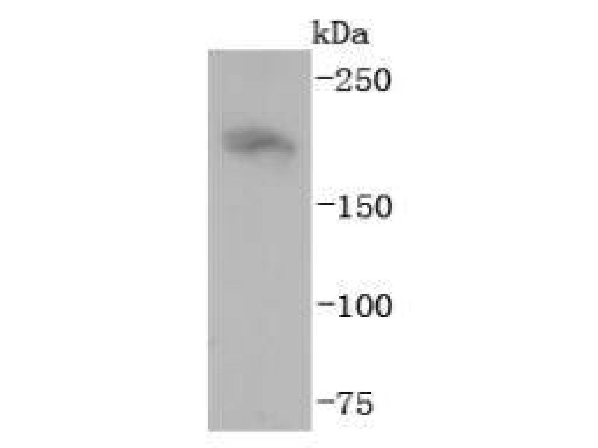 Western blot analysis of Neurofilament heavy polypeptide on mouse brain tissue lysates. Proteins were transferred to a PVDF membrane and blocked with 5% BSA in PBS for 1 hour at room temperature. The primary antibody (ET1702-72, 1/500) was used in 5% BSA at room temperature for 2 hours. Goat Anti-Rabbit IgG - HRP Secondary Antibody (HA1001) at 1:5,000 dilution was used for 1 hour at room temperature.