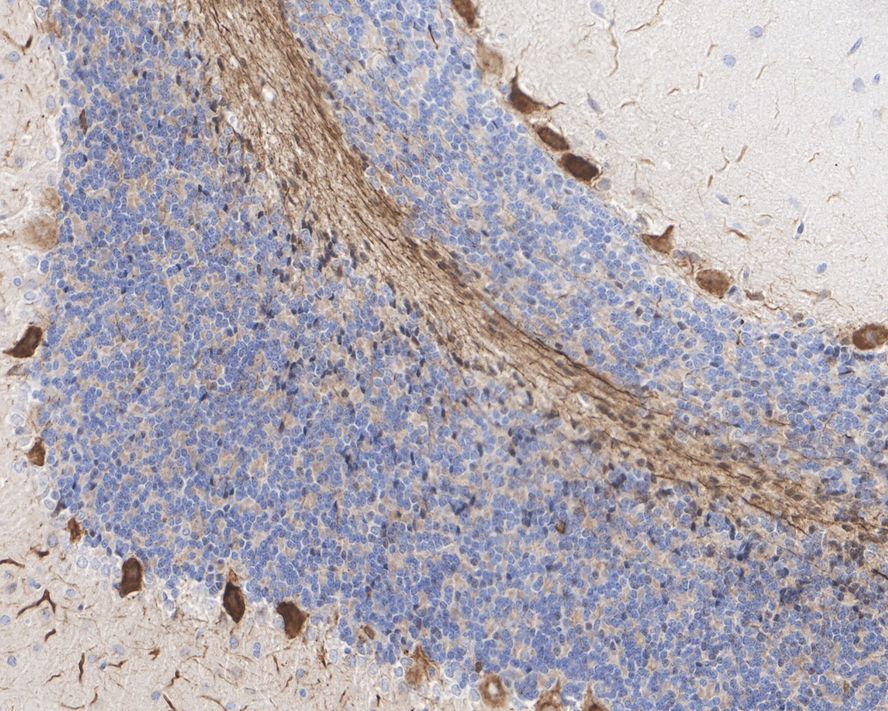 Immunohistochemical analysis of paraffin-embedded mouse cerebellum tissue with Rabbit anti-Neurofilament heavy polypeptide antibody (ET1702-72) at 1/1,000 dilution.<br />
<br />
The section was pre-treated using heat mediated antigen retrieval with Tris-EDTA buffer (pH 9.0) for 20 minutes. The tissues were blocked in 1% BSA for 20 minutes at room temperature, washed with ddH2O and PBS, and then probed with the primary antibody (ET1702-72) at 1/1,000 dilution for 1 hour at room temperature. The detection was performed using an HRP conjugated compact polymer system. DAB was used as the chromogen. Tissues were counterstained with hematoxylin and mounted with DPX.