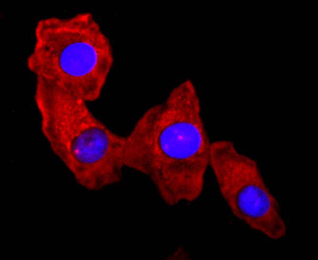 ICC staining of S100A9 in Hela cells (red). Formalin fixed cells were permeabilized with 0.1% Triton X-100 in TBS for 10 minutes at room temperature and blocked with 10% negative goat serum for 15 minutes at room temperature. Cells were probed with the primary antibody (ET1702-73, 1/50) for 1 hour at room temperature, washed with PBS. Alexa Fluor®594 conjugate-Goat anti-Rabbit IgG was used as the secondary antibody at 1/1,000 dilution. The nuclear counter stain is DAPI (blue).
