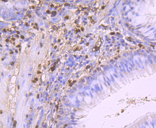 Immunohistochemical analysis of paraffin-embedded human spleen tissue using anti-S100A9 antibody. The section was pre-treated using heat mediated antigen retrieval with Tris-EDTA buffer (pH 9.0) for 20 minutes.The tissues were blocked in 1% BSA for 30 minutes at room temperature, washed with ddH2O and PBS, and then probed with the primary antibody (ET1702-73, 1/50) for 30 minutes at room temperature. The detection was performed using an HRP conjugated compact polymer system. DAB was used as the chromogen. Tissues were counterstained with hematoxylin and mounted with DPX.