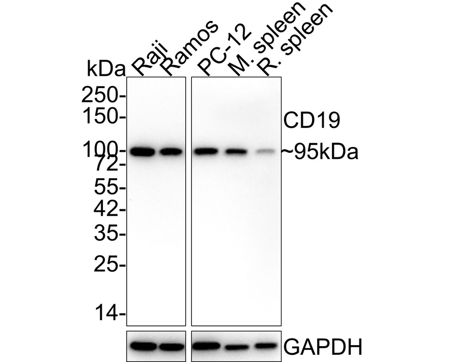 Western blot analysis of CD19 on different lysates. Proteins were transferred to a PVDF membrane and blocked with 5% BSA in PBS for 1 hour at room temperature. The primary antibody (ET1702-74, 1/500) was used in 5% BSA at room temperature for 2 hours. Goat Anti-Rabbit IgG - HRP Secondary Antibody (HA1001) at 1:5,000 dilution was used for 1 hour at room temperature.<br />
Positive control: <br />
Lane 1: Daudi cell lysate<br />
Lane 2: 293 cell lysate<br />
Lane 3: Jurkat cell lysate<br />
Lane 4: rat brain tissue lysate
