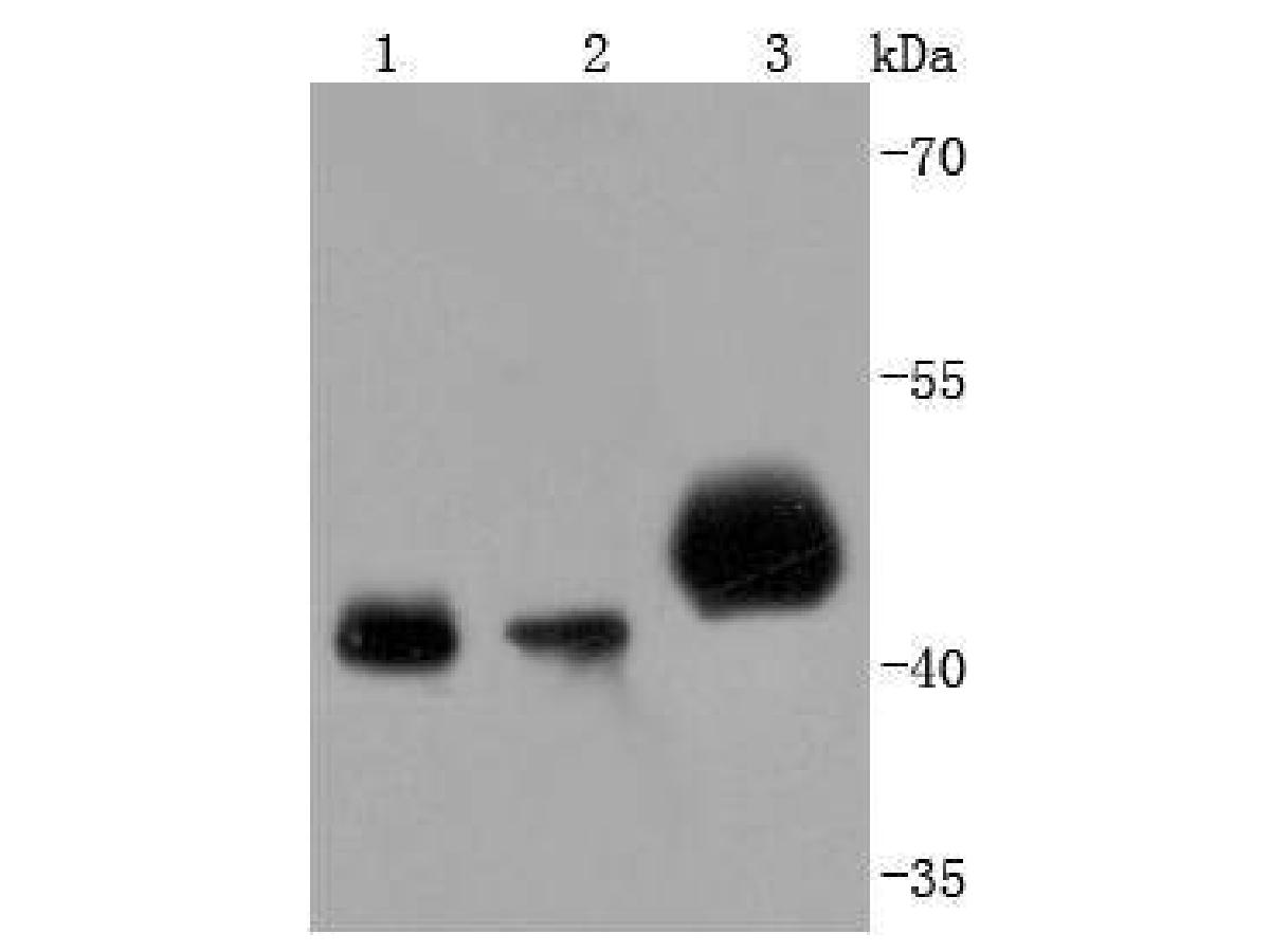 Western blot analysis of PDHA1 on different lysates. Proteins were transferred to a PVDF membrane and blocked with 5% BSA in PBS for 1 hour at room temperature. The primary antibody (ET1702-75, 1/500) was used in 5% BSA at room temperature for 2 hours. Goat Anti-Rabbit IgG - HRP Secondary Antibody (HA1001) at 1:5,000 dilution was used for 1 hour at room temperature.<br />
Positive control: <br />
Lane 1: 293T cell lysate<br />
Lane 2: A431 cell lysate<br />
Lane 3: mouse heart tissue lysate