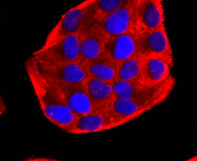 ICC staining of PDHA1 in Hela cells (red). Formalin fixed cells were permeabilized with 0.1% Triton X-100 in TBS for 10 minutes at room temperature and blocked with 1% Blocker BSA for 15 minutes at room temperature. Cells were probed with the primary antibody (ET1702-75, 1/50) for 1 hour at room temperature, washed with PBS. Alexa Fluor®594 Goat anti-Rabbit IgG was used as the secondary antibody at 1/1,000 dilution. The nuclear counter stain is DAPI (blue).