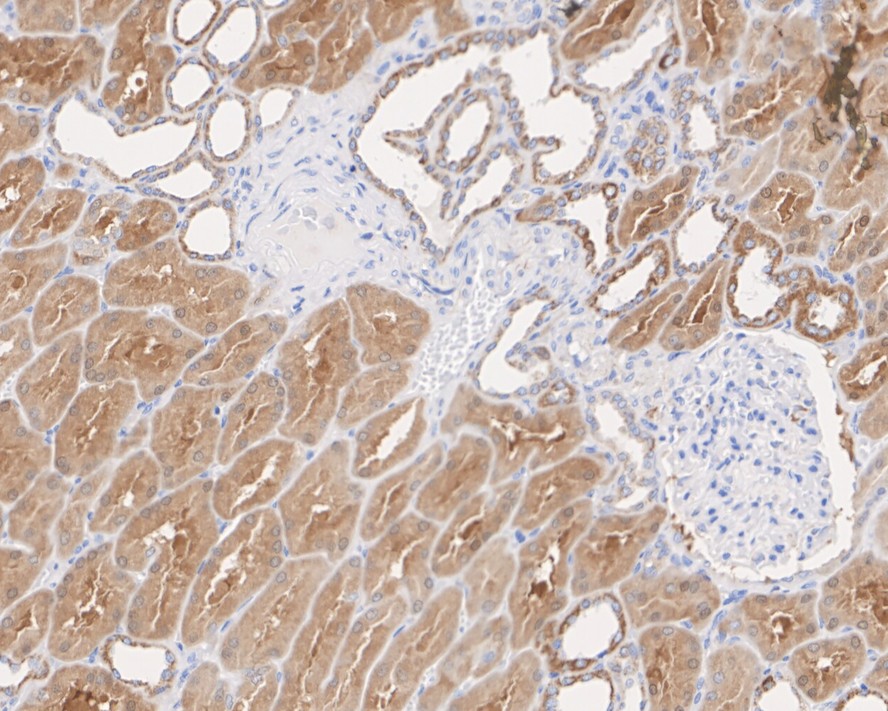 Immunohistochemical analysis of paraffin-embedded human kidney tissue using anti-PDHA1 antibody. The section was pre-treated using heat mediated antigen retrieval with Tris-EDTA buffer (pH 8.0-8.4) for 20 minutes.The tissues were blocked in 5% BSA for 30 minutes at room temperature, washed with ddH2O and PBS, and then probed with the primary antibody (ET1702-75, 1/50) for 30 minutes at room temperature. The detection was performed using an HRP conjugated compact polymer system. DAB was used as the chromogen. Tissues were counterstained with hematoxylin and mounted with DPX.