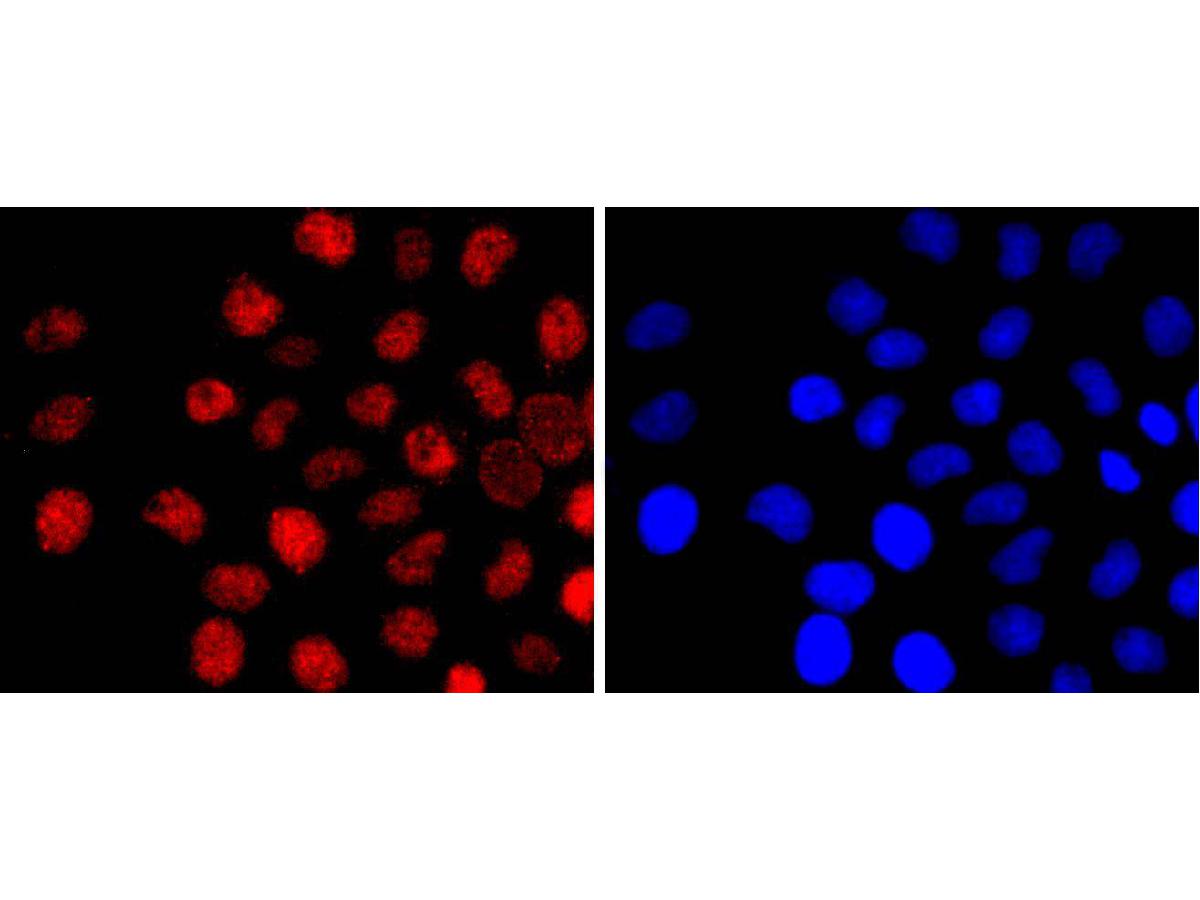 ICC staining of Ctip2 in LO2 cells (red). Formalin fixed cells were permeabilized with 0.1% Triton X-100 in TBS for 10 minutes at room temperature and blocked with 1% Blocker BSA for 15 minutes at room temperature. Cells were probed with the primary antibody (ET1702-76, 1/50) for 1 hour at room temperature, washed with PBS. Alexa Fluor®594 Goat anti-Rabbit IgG was used as the secondary antibody at 1/1,000 dilution. The nuclear counter stain is DAPI (blue).