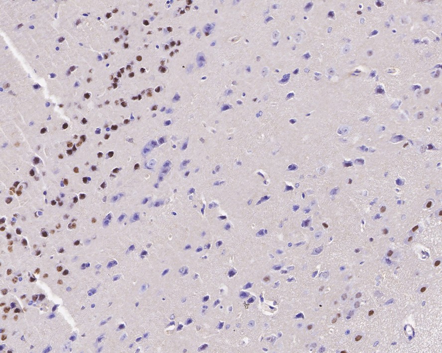 Immunohistochemical analysis of paraffin-embedded mouse brain tissue with Rabbit anti-Ctip2 antibody (ET1702-76) at 1/1,000 dilution.<br />
<br />
The section was pre-treated using heat mediated antigen retrieval with sodium citrate buffer (pH 6.0) for 2 minutes. The tissues were blocked in 1% BSA for 20 minutes at room temperature, washed with ddH2O and PBS, and then probed with the primary antibody (ET1702-76) at 1/1,000 dilution for 1 hour at room temperature. The detection was performed using an HRP conjugated compact polymer system. DAB was used as the chromogen. Tissues were counterstained with hematoxylin and mounted with DPX.