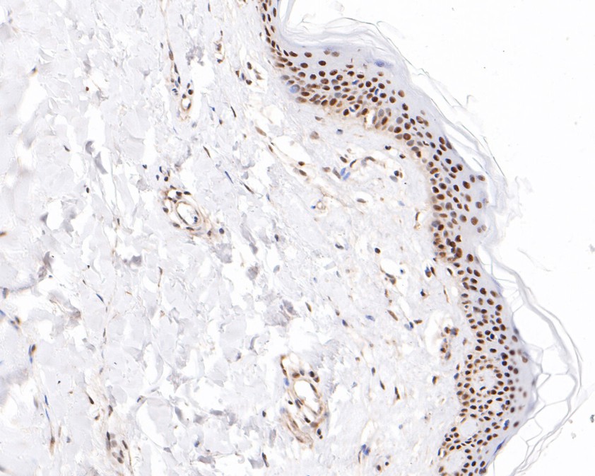 Immunohistochemical analysis of paraffin-embedded mouse brain tissue using anti-Ctip2 antibody. The section was pre-treated using heat mediated antigen retrieval with sodium citrate buffer (pH 6.0) for 20 minutes. The tissues were blocked in 5% BSA for 30 minutes at room temperature, washed with ddH2O and PBS, and then probed with the primary antibody (ET1702-76, 1/50)  for 30 minutes at room temperature. The detection was performed using an HRP conjugated compact polymer system. DAB was used as the chromogen. Tissues were counterstained with hematoxylin and mounted with DPX.