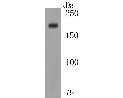 Western blot analysis of Dnmt1 on HepG2 cell lysates. Proteins were transferred to a PVDF membrane and blocked with 5% BSA in PBS for 1 hour at room temperature. The primary antibody (ET1702-77, 1/500) was used in 5% BSA at room temperature for 2 hours. Goat Anti-Rabbit IgG - HRP Secondary Antibody (HA1001) at 1:5,000 dilution was used for 1 hour at room temperature.