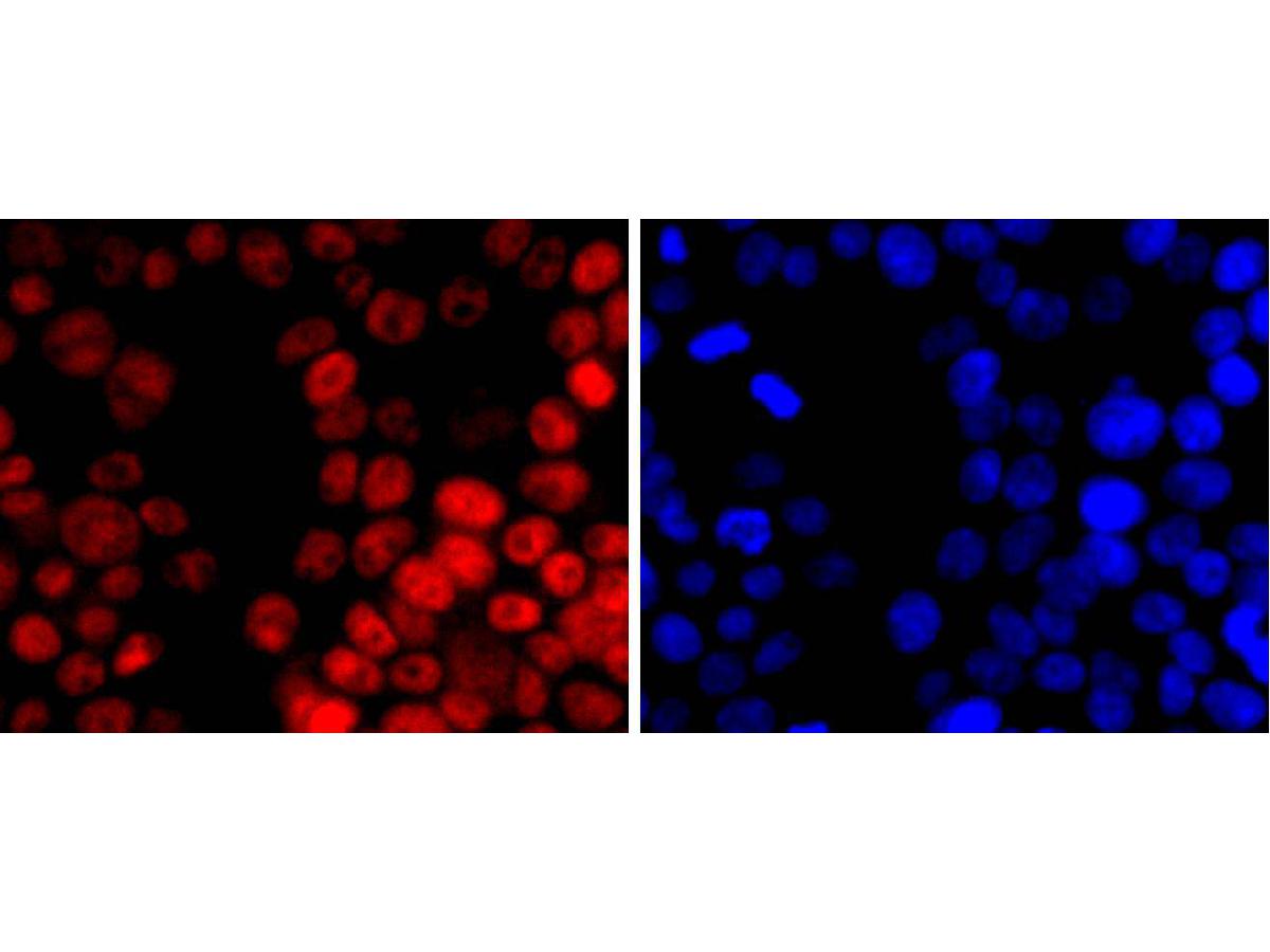 ICC staining of Dnmt1 in HepG2 cells (red). Formalin fixed cells were permeabilized with 0.1% Triton X-100 in TBS for 10 minutes at room temperature and blocked with 1% Blocker BSA for 15 minutes at room temperature. Cells were probed with the primary antibody (ET1702-77, 1/50) for 1 hour at room temperature, washed with PBS. Alexa Fluor®594 Goat anti-Rabbit IgG was used as the secondary antibody at 1/1,000 dilution. The nuclear counter stain is DAPI (blue).