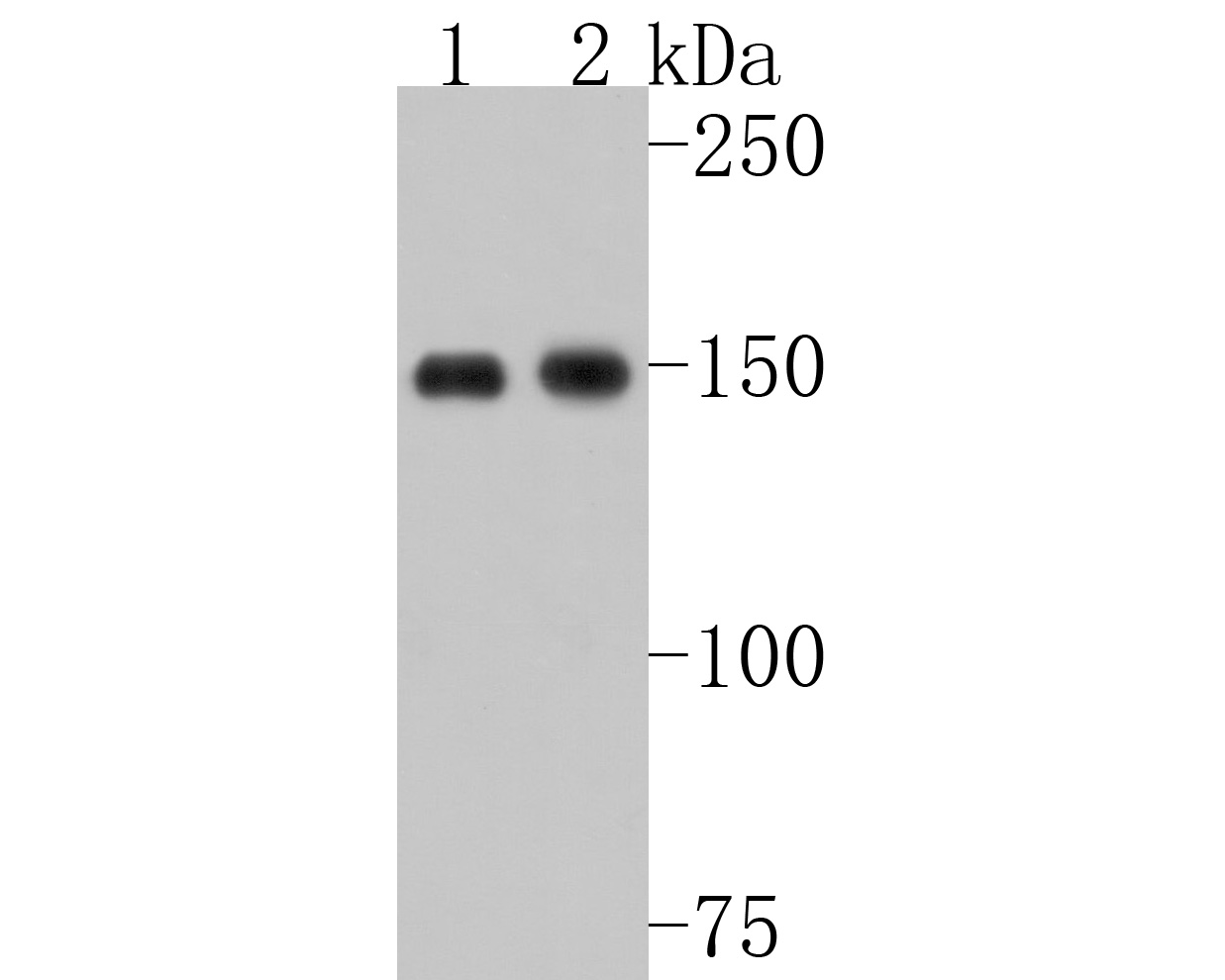 Western blot analysis of ASPP2 on different lysates. Proteins were transferred to a PVDF membrane and blocked with 5% BSA in PBS for 1 hour at room temperature. The primary antibody (ET1702-79, 1/500) was used in 5% BSA at room temperature for 2 hours. Goat Anti-Rabbit IgG - HRP Secondary Antibody (HA1001) at 1:200,000 dilution was used for 1 hour at room temperature.<br />
Positive control: <br />
Lane 1: Hela cell lysate<br />
Lane 2: MCF-7 cell lysate