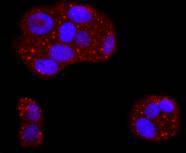 ICC staining of ASPP2 in Hela cells (red). Formalin fixed cells were permeabilized with 0.1% Triton X-100 in TBS for 10 minutes at room temperature and blocked with 10% negative goat serum for 15 minutes at room temperature. Cells were probed with the primary antibody (ET1702-79, 1/50) for 1 hour at room temperature, washed with PBS. Alexa Fluor®594 conjugate-Goat anti-Rabbit IgG was used as the secondary antibody at 1/1,000 dilution. The nuclear counter stain is DAPI (blue).