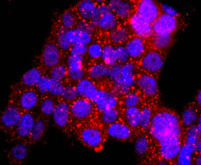 ICC staining of ASPP2 in 293T cells (red). Formalin fixed cells were permeabilized with 0.1% Triton X-100 in TBS for 10 minutes at room temperature and blocked with 10% negative goat serum for 15 minutes at room temperature. Cells were probed with the primary antibody (ET1702-79, 1/50) for 1 hour at room temperature, washed with PBS. Alexa Fluor®594 conjugate-Goat anti-Rabbit IgG was used as the secondary antibody at 1/1,000 dilution. The nuclear counter stain is DAPI (blue).