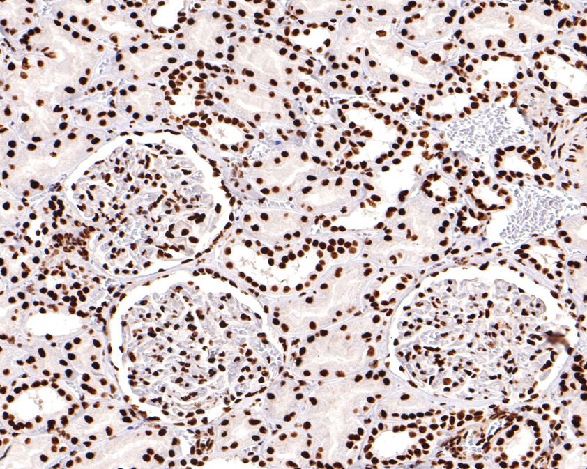 Immunohistochemical analysis of paraffin-embedded human kidney tissue using anti-ASPP2 antibody. The section was pre-treated using heat mediated antigen retrieval with sodium citrate buffer (pH 6.0) for 20 minutes. The tissues were blocked in 1% BSA for 30 minutes at room temperature, washed with ddH2O and PBS, and then probed with the primary antibody (ET1702-79, 1/400)  for 30 minutes at room temperature. The detection was performed using an HRP conjugated compact polymer system. DAB was used as the chromogen. Tissues were counterstained with hematoxylin and mounted with DPX.