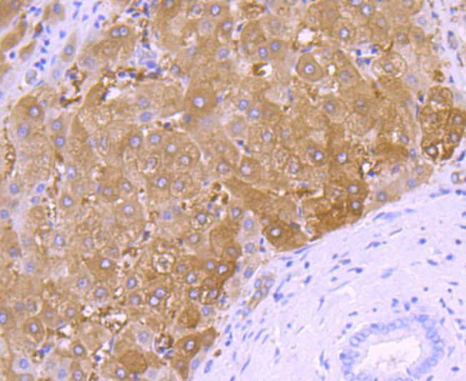 Immunohistochemical analysis of paraffin-embedded human liver tissue using anti-58K Golgi protein antibody. Counter stained with hematoxylin.