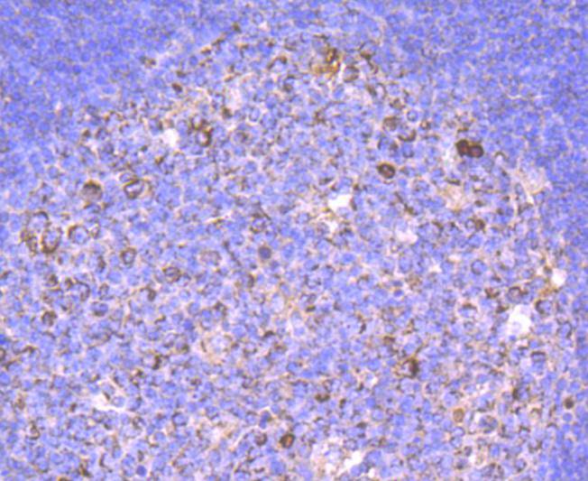 Immunohistochemical analysis of paraffin-embedded human tonsil tissue using anti-Human IgM antibody. The section was pre-treated using heat mediated antigen retrieval with Tris-EDTA buffer (pH 9.0) for 20 minutes.The tissues were blocked in 1% BSA for 30 minutes at room temperature, washed with ddH2O and PBS, and then probed with the primary antibody (ET1702-81, 1/50) for 30 minutes at room temperature. The detection was performed using an HRP conjugated compact polymer system. DAB was used as the chromogen. Tissues were counterstained with hematoxylin and mounted with DPX.