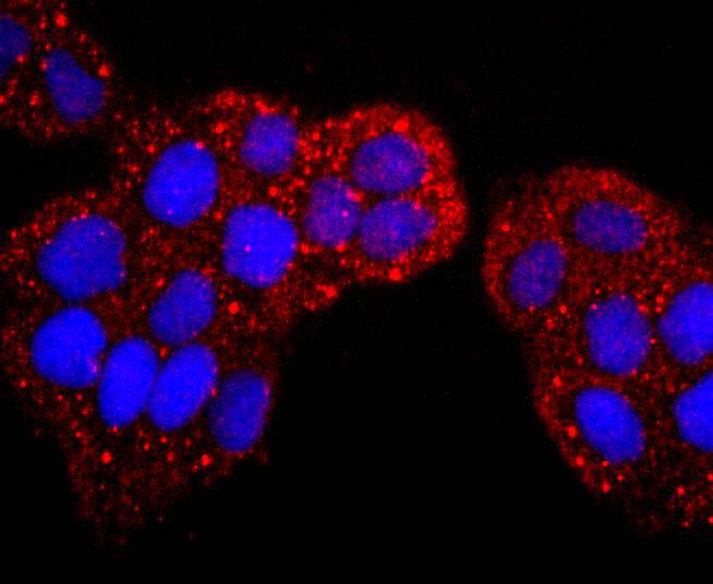 ICC staining of S100P in Hela cells (red). Formalin fixed cells were permeabilized with 0.1% Triton X-100 in TBS for 10 minutes at room temperature and blocked with 1% Blocker BSA for 15 minutes at room temperature. Cells were probed with the primary antibody (ET1702-82, 1/50) for 1 hour at room temperature, washed with PBS. Alexa Fluor®594 Goat anti-Rabbit IgG was used as the secondary antibody at 1/1,000 dilution. The nuclear counter stain is DAPI (blue).