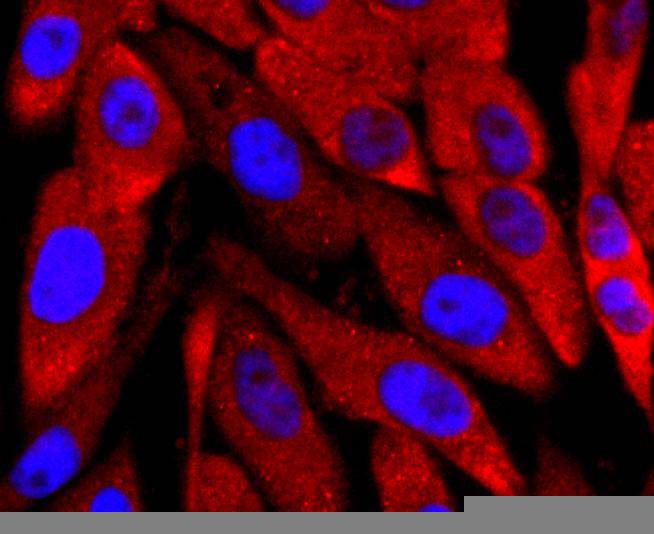 ICC staining of PGP9.5 in PC-3M cells (red). Formalin fixed cells were permeabilized with 0.1% Triton X-100 in TBS for 10 minutes at room temperature and blocked with 1% Blocker BSA for 15 minutes at room temperature. Cells were probed with the primary antibody (ET1702-83, 1/50) for 1 hour at room temperature, washed with PBS. Alexa Fluor®594 Goat anti-Rabbit IgG was used as the secondary antibody at 1/1,000 dilution. The nuclear counter stain is DAPI (blue).
