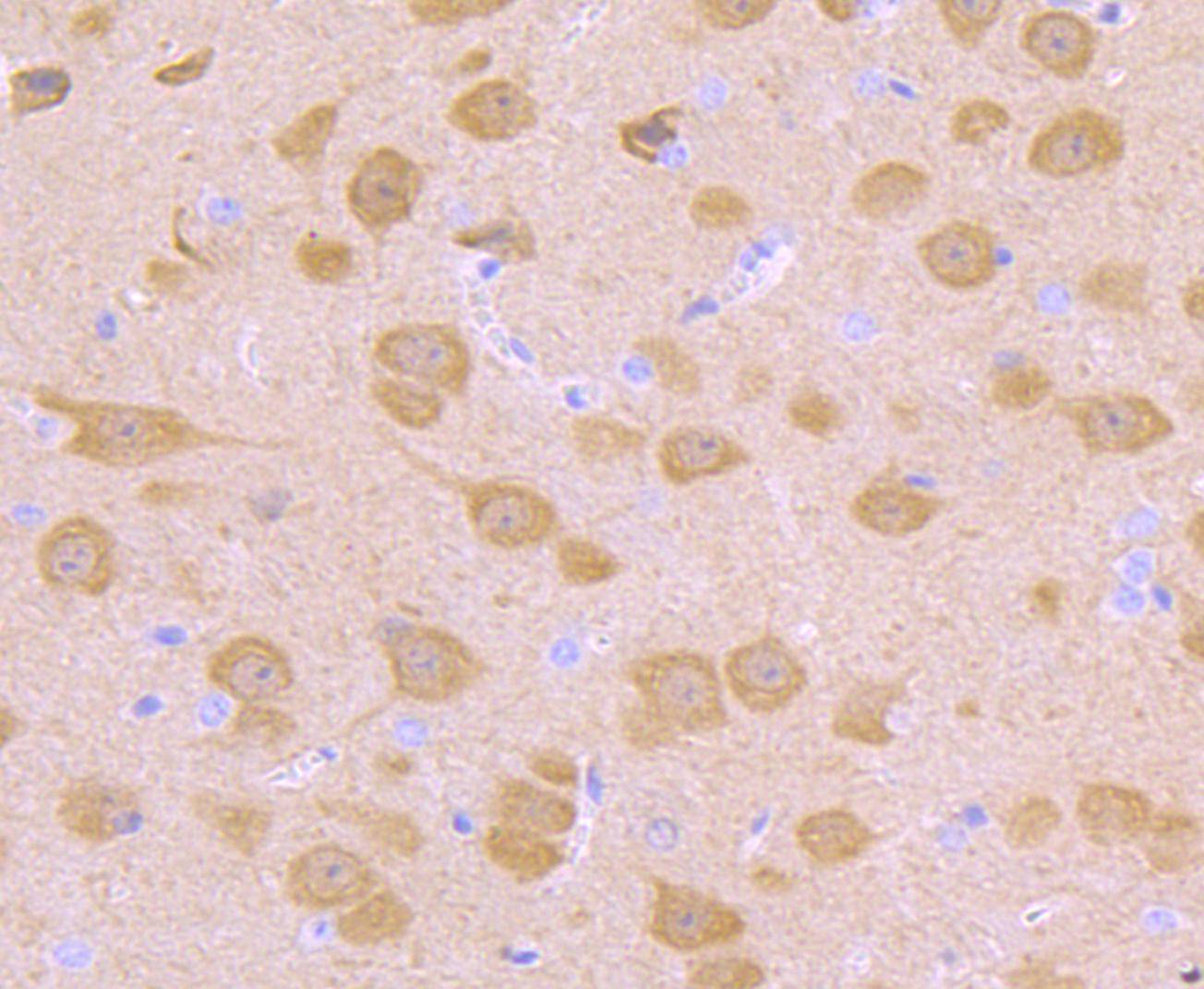 Immunohistochemical analysis of paraffin-embedded mouse brain tissue using anti-PGP9.5 antibody. The section was pre-treated using heat mediated antigen retrieval with Tris-EDTA buffer (pH 8.0-8.4) for 20 minutes.The tissues were blocked in 5% BSA for 30 minutes at room temperature, washed with ddH2O and PBS, and then probed with the primary antibody (ET1702-83, 1/50) for 30 minutes at room temperature. The detection was performed using an HRP conjugated compact polymer system. DAB was used as the chromogen. Tissues were counterstained with hematoxylin and mounted with DPX.