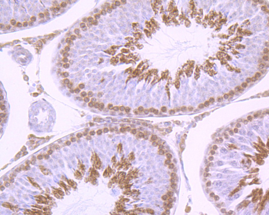 Immunohistochemical analysis of paraffin-embedded rat testis tissue using anti-Gli1 antibody. The section was pre-treated using heat mediated antigen retrieval with Tris-EDTA buffer (pH 8.0-8.4) for 20 minutes.The tissues were blocked in 5% BSA for 30 minutes at room temperature, washed with ddH2O and PBS, and then probed with the primary antibody (ET1702-85, 1/50) for 30 minutes at room temperature. The detection was performed using an HRP conjugated compact polymer system. DAB was used as the chromogen. Tissues were counterstained with hematoxylin and mounted with DPX.