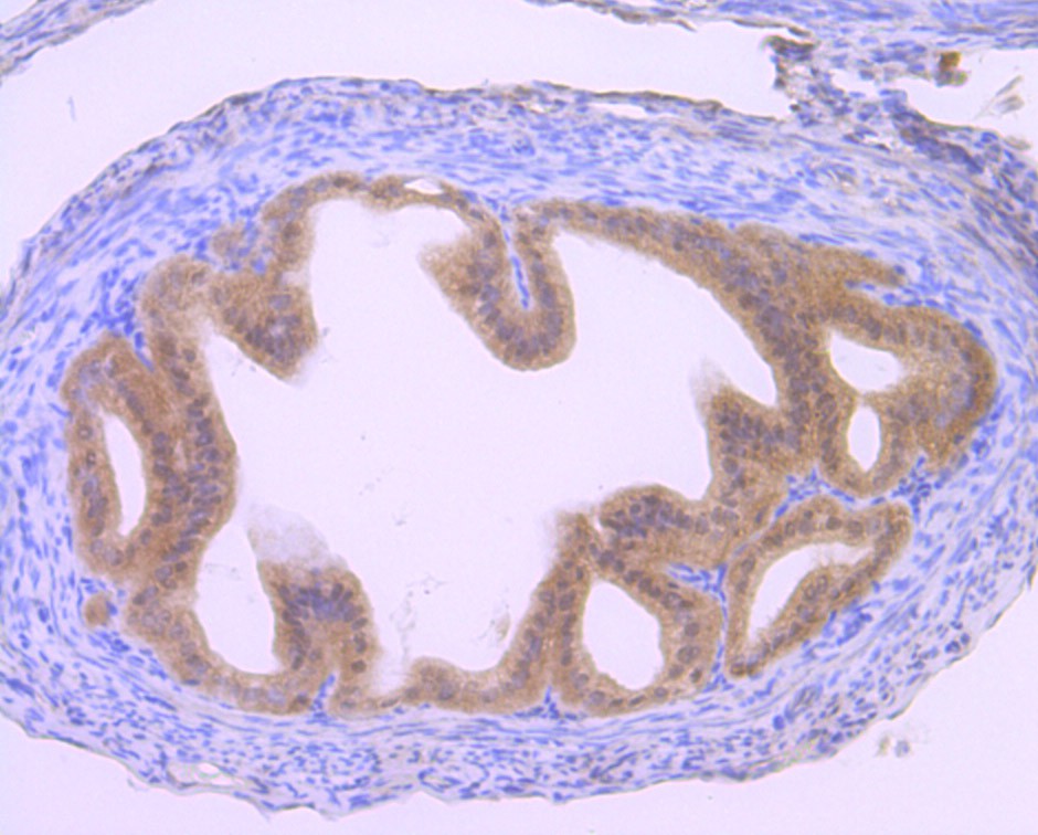 Immunohistochemical analysis of paraffin-embedded mouse fallopian tissue using anti-Gli1 antibody. The section was pre-treated using heat mediated antigen retrieval with Tris-EDTA buffer (pH 8.0-8.4) for 20 minutes.The tissues were blocked in 5% BSA for 30 minutes at room temperature, washed with ddH2O and PBS, and then probed with the primary antibody (ET1702-85, 1/50) for 30 minutes at room temperature. The detection was performed using an HRP conjugated compact polymer system. DAB was used as the chromogen. Tissues were counterstained with hematoxylin and mounted with DPX.
